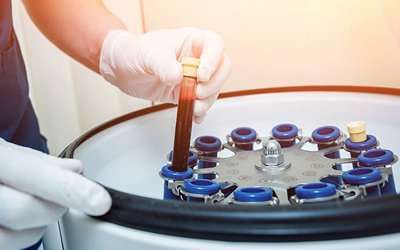 Introducing PRF – Platelet Rich Fibrin