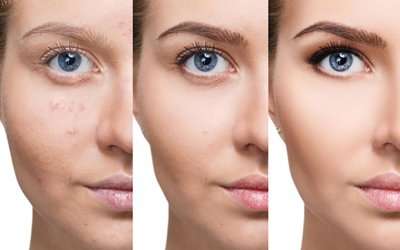 Insights Meso Foundation ‘’BB Glow Treatment’’ for Porcelain Skin Effect