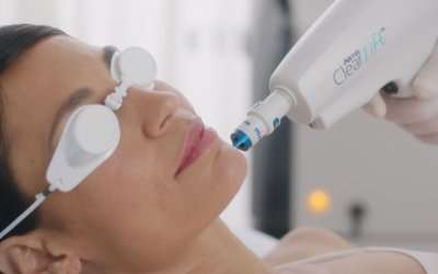 ClearLift from Harmony XL Pro – Get the Celebrity Treatment