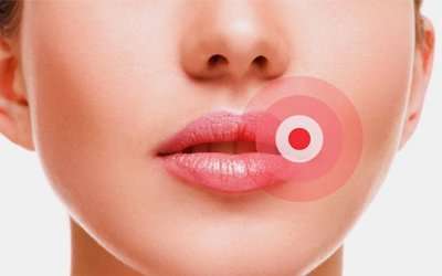 Insights 5 Most Common Lip Problems