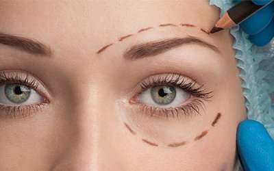 Non-Surgical Blepharoplasty for Droopy and Hooded Eyelids