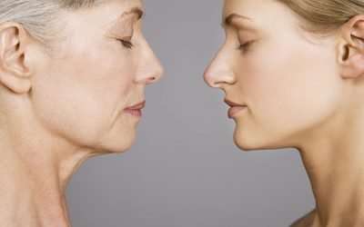 Skin Laxity – Causes, Prevention and Reversal