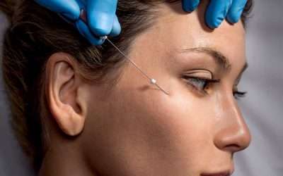 Insights Facial Thread Lift