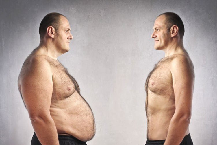 weight-loss-male-322 weight loss clinic