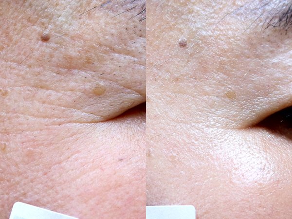 gouri eye area gouri