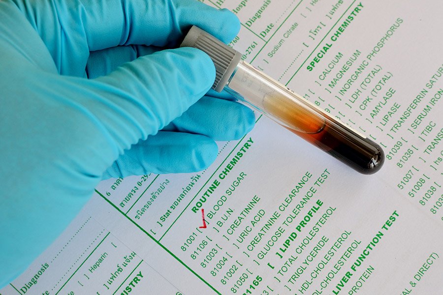 vitamin-deficiency-6 ozempic face