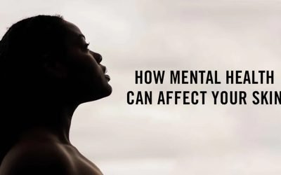 Psychodermatology: The Skin-Mind Connection