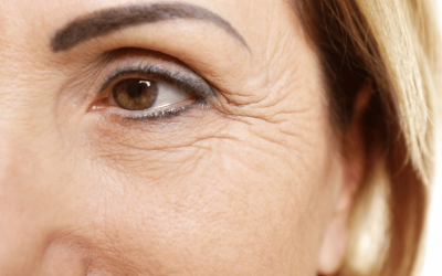 Insights 11 Effective Under-Eye Wrinkle Treatments