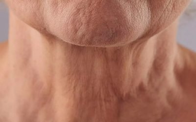 Liquid Neck Lift