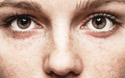 Insights Biomimetic Peptides For Prominent Eye Bags