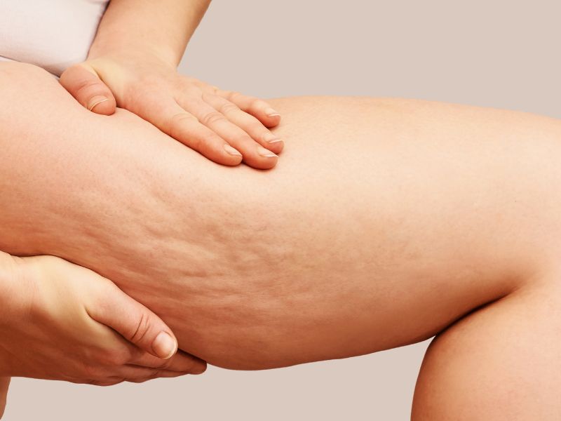 Body Treatments anti-cellulite treatments
