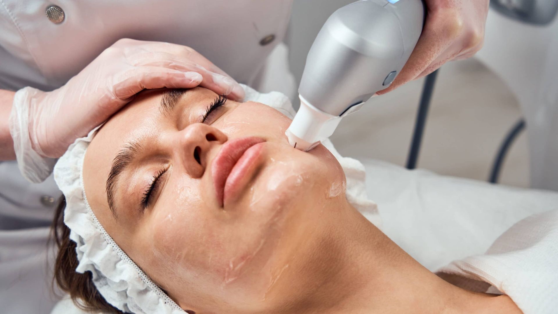 threadlift
