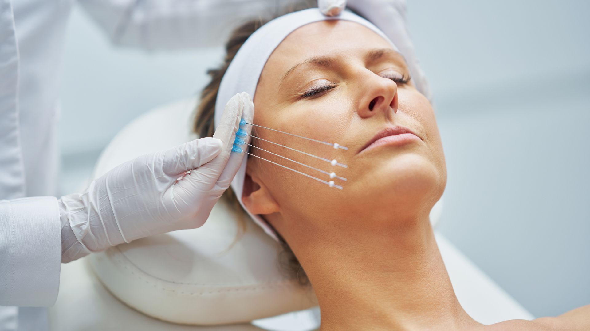 threadlift