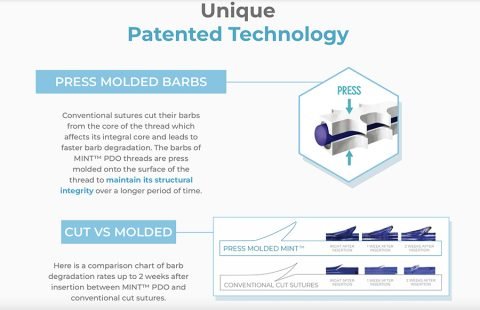 MINT Threads: A Revolutionary Approach to Thread Lifts | Aestha Clinic