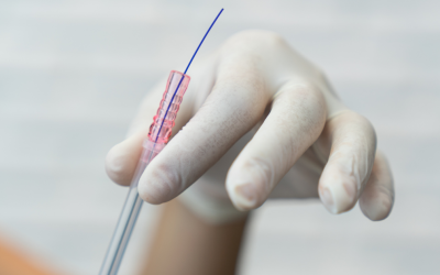 MINT Threads: A Revolutionary Approach to Thread Lifts