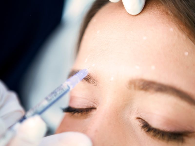 botox summer treatment