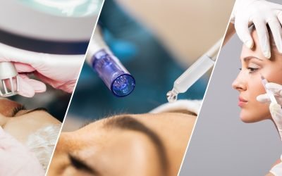 Exclusive Activating Skin Stemcell Therapy