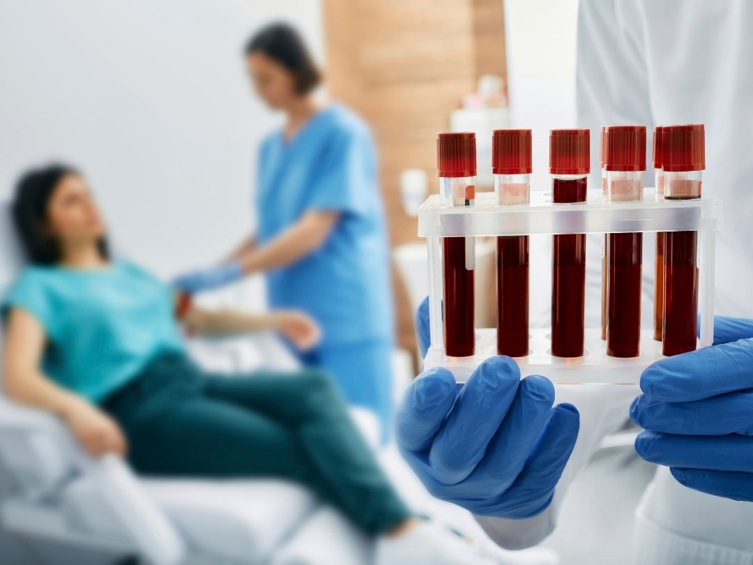 health testing 483 glp-1