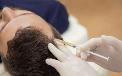 Introduces Revolutionary Nano Fat Grafting with Stem Cells for Hair Loss Treatment