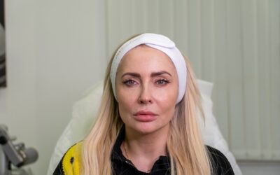 Collagen Biostimulators in London