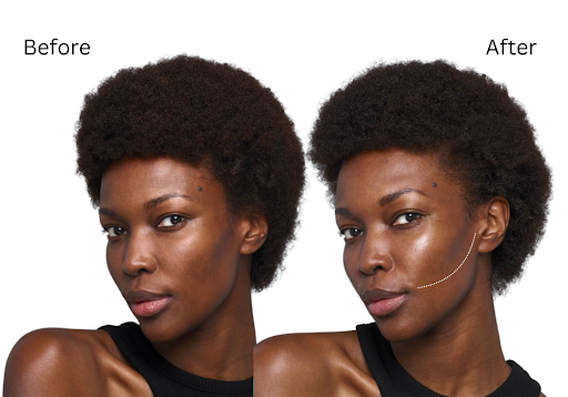 before-after ozempic face