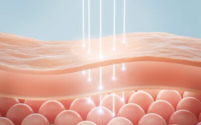 Collagen Biostimulation Treatments: Rebuild Skin Naturally