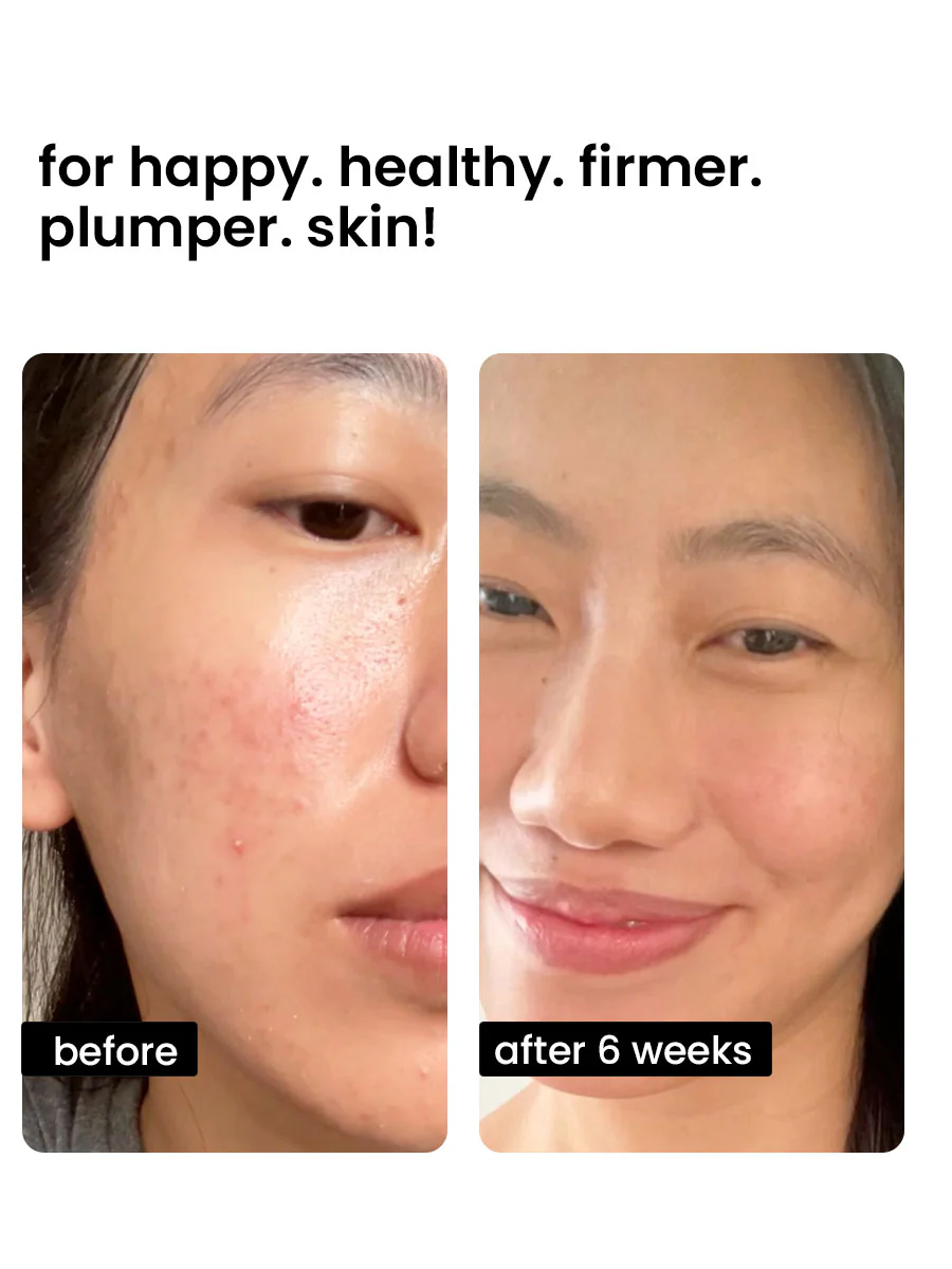 ghk-cu before and after acne GHK-Cu – Ultra Labs main image 1