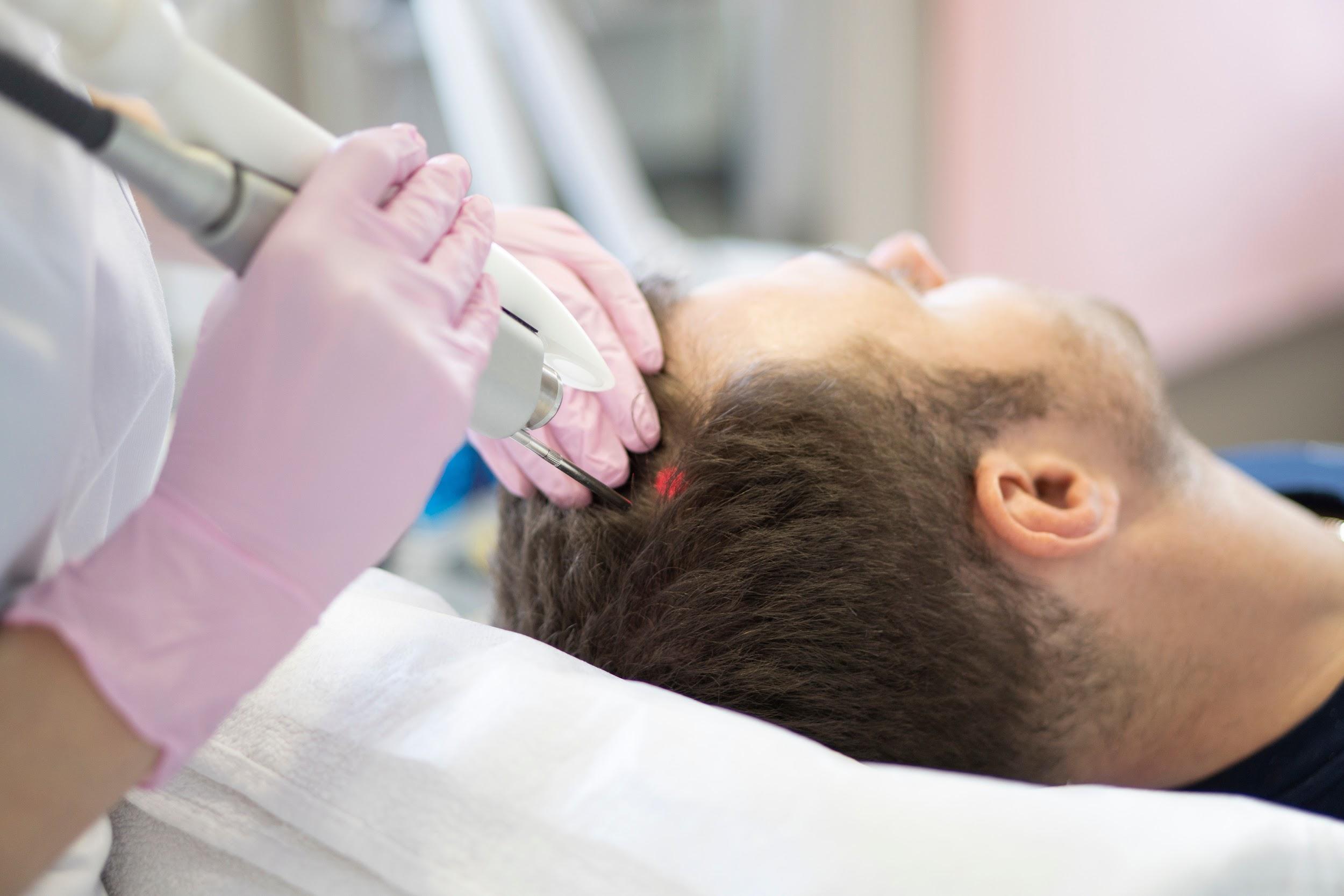 Hair Growth Stimulation